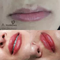 Fuat TEKEDERELİ Beauty Center