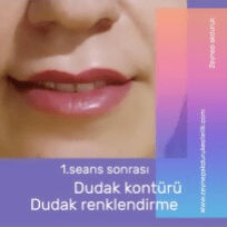 Zeynep Akduruk