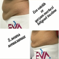 Eva estetik ve yaşam merkezi